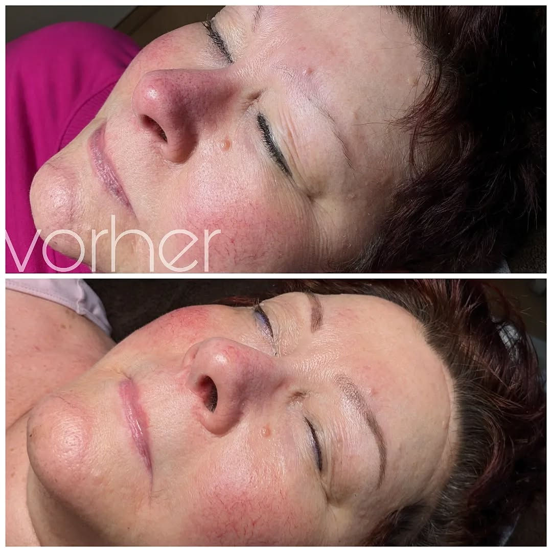 Vorher-Nachher-Komposition von Powderbrows Permanent Make-up